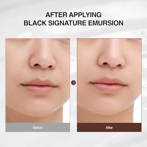 Avon Skin So Soft Exfoliating Body Pads for Acne Prone Skin, 70 Ct ? with Salicylic Acid, Hyaluronic Acid & Panthenol ? Smooths Texture, Hydrates & Brightens, Fragrance-Free