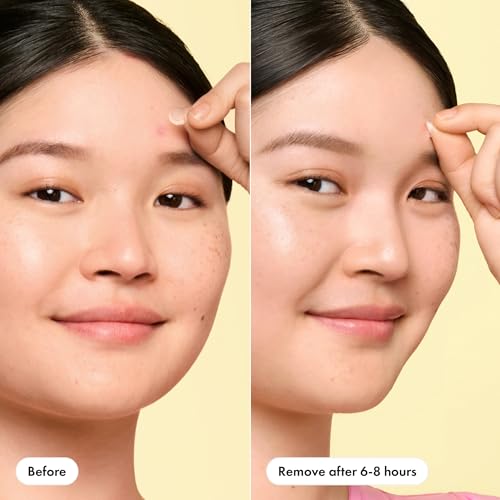 Hero Cosmetics Mighty Patch Mini Invisible+ Acne Pimple Patches Pack of 30 for Daytime Use