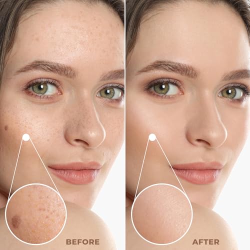 Profusion Cosmetics Lightweight Liquid Foundation for a Flawless and Elegant Radiance, Breathable Makeup that Improves Uneven Skin Tone, Vegan & Cruelty-Free - Light 1