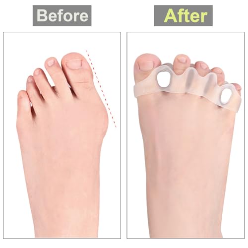 Silicone Toe Separators for Bunions & Hammer Toes (2 Pack)