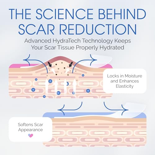 C-Section Silicone Scar Sheets for Cesarean Incision Scars ? Medical Grade Reusable Silicone Scar Strips for Postpartum Recovery ? Clear Breathable Silicone Tape - 7¡±, 8-Pack