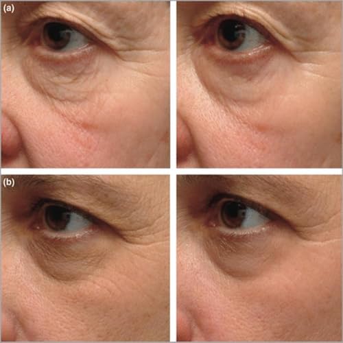 Instant Firming Eye Serum - Anti-Aging Under Eye Cream 0.49oz
