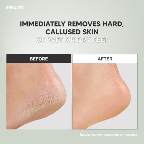 F3 Systems Double-Sided Emery Foot File Callus & Dead Skin Remover