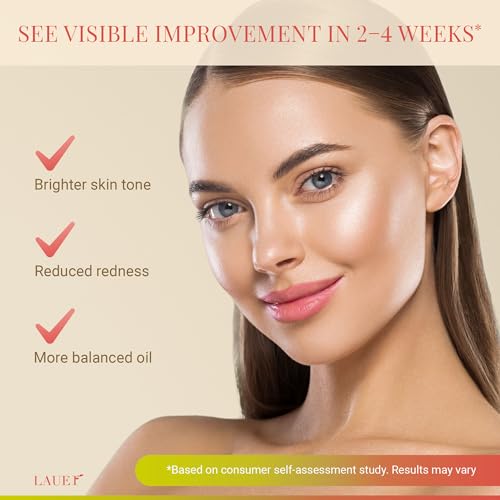 Azelaic Acid Face Serum 10% for Women ? Brightening & Clarifying Facial Serum with Niacinamide, Vitamin C, Hyaluronic Acid & Jojoba Oil ? Redness & Dark Spot Balancing, 1 fl oz