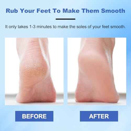 Veinsgrain Foot File, Nano Glass Foot File, Hard Skin Remover Nano-Glass Foot File, Veins Grain Foot File, Professional Foot Care Tools, Pedicure Tool for Smooth Feet (Gold)