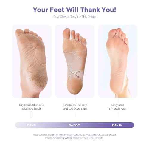Foot Peel Mask, Lavender Foot Mask Natural Exfoliator for Dry Dead Skin, Callus, Peeling Foot Mask Repairs Heels & Removes Cracked Feet & Rough Heels Enjoy Baby Soft Smooth Feet