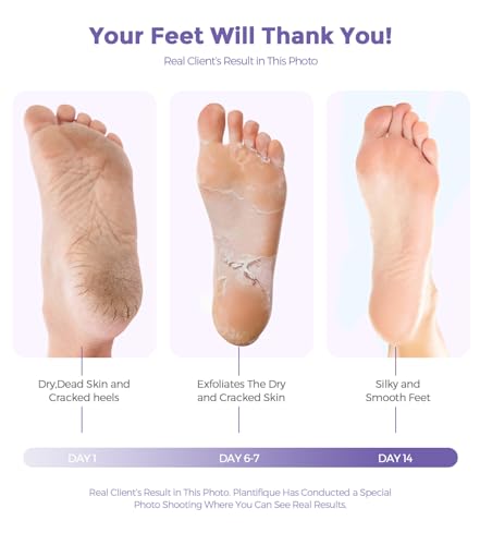 Lavender Foot Peel Mask Exfoliator for Dry, Cracked, Rough Heels - Natural Foot Care
