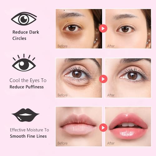 Collagen Eye & Lip Mask Set - 30 Pairs for Dark Circles & Fine Lines