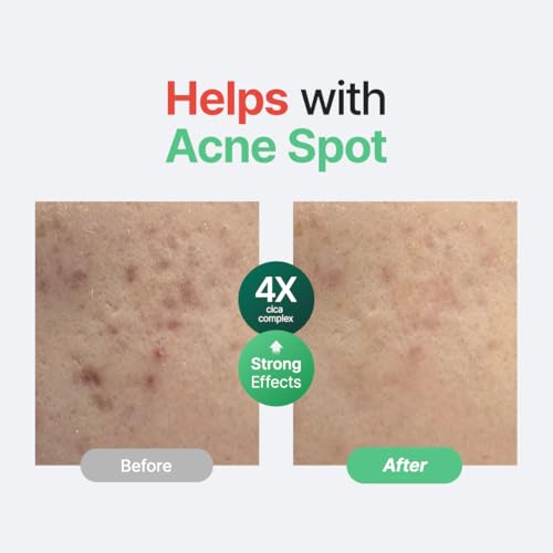 PURITO Centella Unscented Serum for Sensitive Skin ? Lightweight Calming & Skin Barrier Repair, 34,860 ppm Soothing Serum, Vegan & Cruelty-Free, Korean Skincare, 2 fl.oz / 60ml