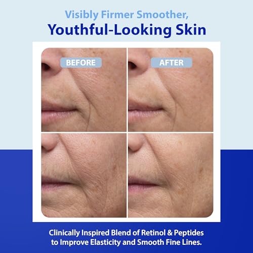Dr. Denese HydroShield Dream Cream 1.7 oz ? Advanced Moisturizer with Ceramides, Retinol and Peptides for Smooth Radiant Skin, Improved Elasticity and Deep Hydration ? Doctor Developed, Cruelty Free