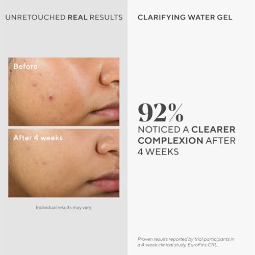 Murad Clarifying Water Gel ? Lightweight Face Moisturizer for Acne-Prone Skin with Salicylic and Hyaluronic Acid for Breakout Prevention, Hydration, and Shine-Free Finish ? 2 Fl Oz