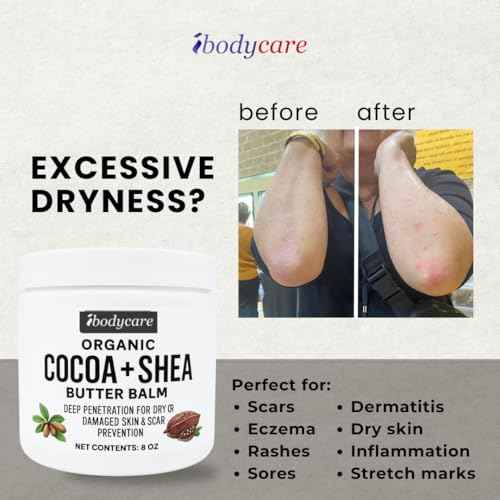 Organic Raw Cocoa Butter Shea Butter Body Balm with Coconut Oil, 8 oz Unrefined Natural Body Butter Blend with Shea Butter Moisture for Women, Baby, Children, Men, All Body (2)