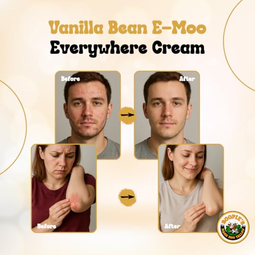 Magic Moo Beef Tallow Vanilla Bean E-Moo Moisturizing Everywhere Suet Tallow Cream with Organic Emu Oil. For Acne, Stretch Marks, Eczema, Hydration, Dry Skin & More! 8oz