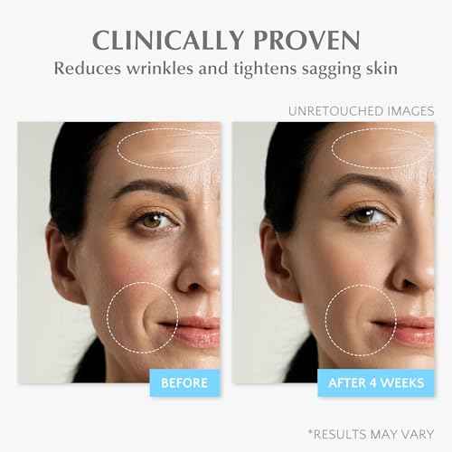 EnaSkin Retinol Collagen Face Cream: Wrinkle Cream for Women, Neck & D?collet? Anti Aging Moisturizer with 7% Hyaluronic Acid Serum - Day/Night Skin Firming & Tightening, 1.7 Oz