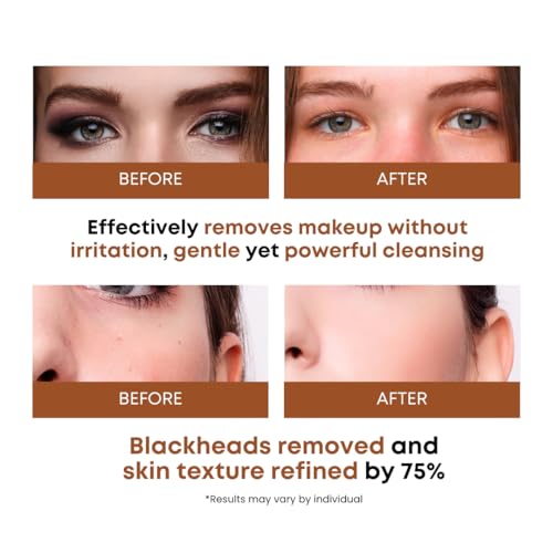 Rice Water Cleansing Pads – Makeup Remover Wipes, 50 Pad