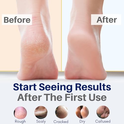 The Yellow Bird All Natural Foot Balm for Cracked Heels & Calluses