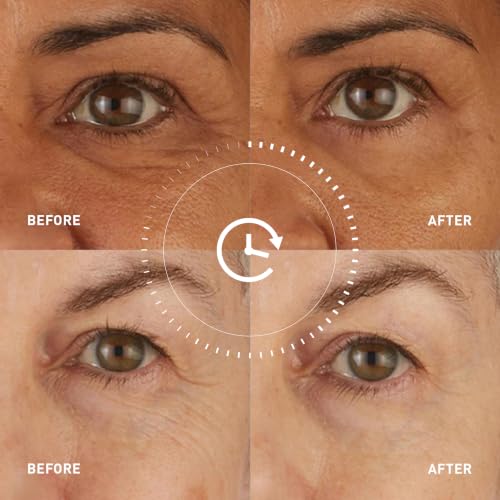 Skyn Iceland Hydro Cool Eye Patches - Firming & De-Puffing