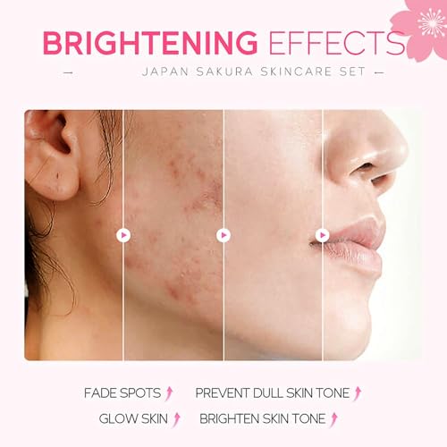 Skin Care Set for Women Girls, Cherry Blossoms Beauty Gift Sets Skin Care Kit with Cleanser, Face Serum, Face Cream,Toner,Eye Cream,Skin Care Routine Kit