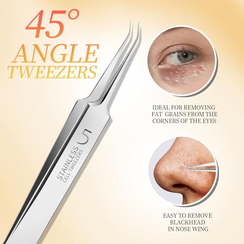 Blackhead Pimple Remover Tweezers Kit - 4 Stainless Steel Precision Tools