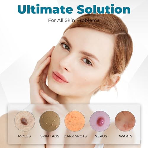 Blue Light Therapy Pen for Acne, Scars, and Skin Tightening