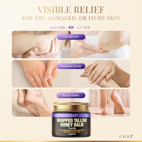Whipped Tallow Honey Balm Soft Smooth Skin Face 100% Grass-Fed Beef Tallow Body Butter Raw Honey All Skin Type Natural Vanilla Moisturizer for Eczema Rashes Dry Skin Sunburn Treatment for Women