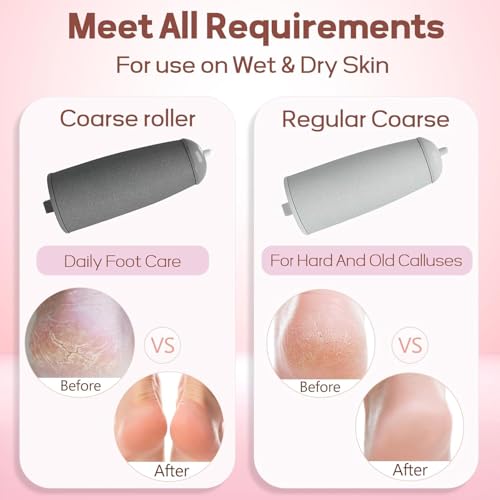 Electric Foot Callus Remover - Rechargeable Pedicure Tool for Smooth Feet