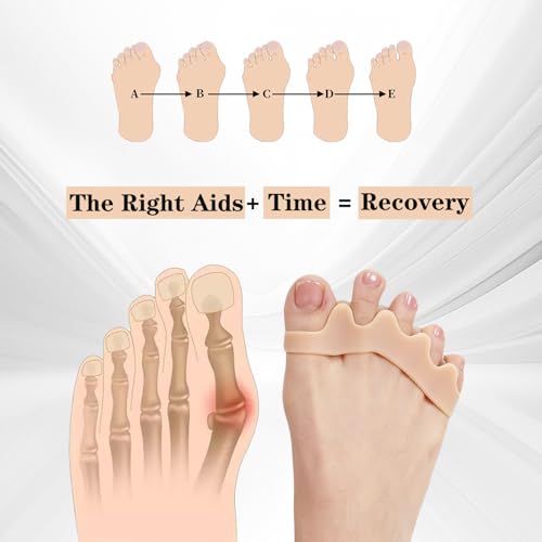 Toe Separators for Women & Men - Gel Plantar Fasciitis Relief, Slim Fit
