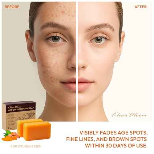 Kojic Acid Soap, Turmeric Soap Bar for Dark Spots Brightening & Moisturizing with Collagen, Vitamin E, Retinol, Hyaluronic Acid, Shea Butter, Paraben & Sulfate-Free 105g x 2 Bars