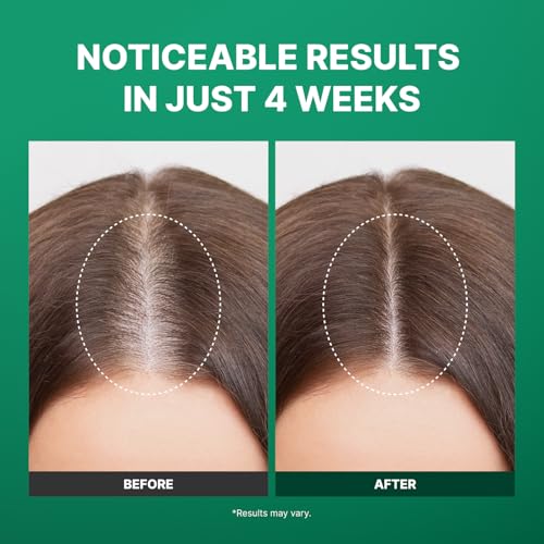 Microneedling Hair Growth Serum with Exosomes & Peppermint Oil - 0.5 fl oz