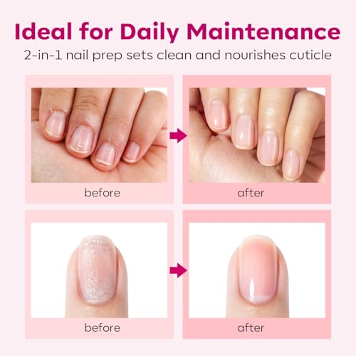 Modelones Cuticle Remover Kit with Nail Oil & Tools