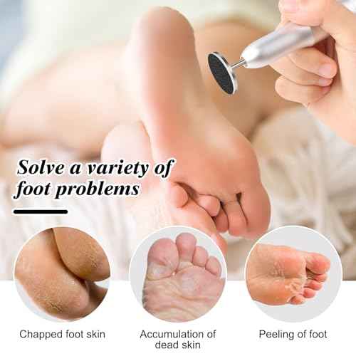 120 Pcs Sanding Paper Disc w/ 2 Metal Bit, 80/120/180/240 Grit Round Pedicure Replacement Sanding Discs for Electric Nail File Bits, Foot File Sandpaper Discs for Dead Skin Foot Callus Remover