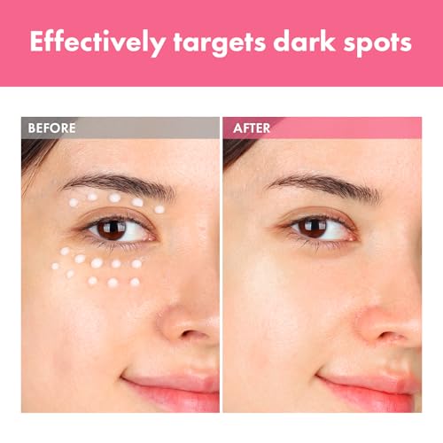 TOSOWOONG 7% Arbutin Spot Cream - Dark Spot & Blemish Treatment 20ml