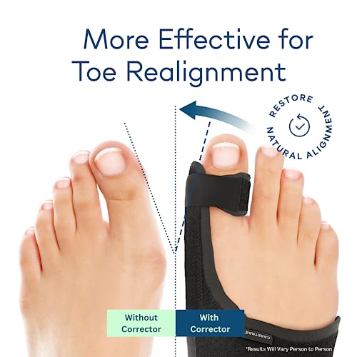 Caretras Bunion Corrector & Toe Straightener for Women & Men - Pain Relief & Comfort