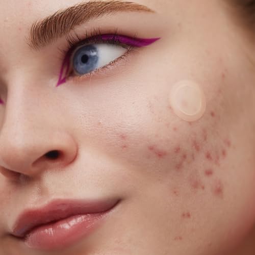 PEACE OUT Early Stage Acne Dots Helps Target Blemishes Below the Surface, Hydrocolloid Pimple Patches Minimize Bumps Before They Appear with Dissolving Microneedles, Salicylic Acid, 8 Count
