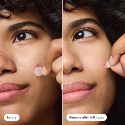 Mighty Patch¢â Invisible+ Patch ? The Barely-There Daytime Hydrocolloid Acne Pimple Patch for Covering Zits and Blemishes, Tapered Edges Designed to Blend Into Skin (72ct) (Pack of 2)
