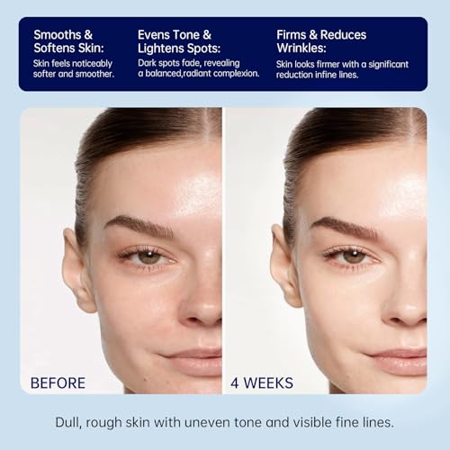 Retinol Firming Face & Neck Cream with Collagen and Hyaluronic Acid ? Anti-Aging Moisturizer for Wrinkles, Lifting & Hydration for Men & Women, 1.7 Fl Oz