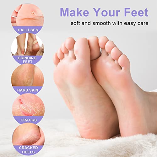 Exfoliating Foot Peeling Mask (5 Pack) - Natural Peel for Dry Skin & Calluses