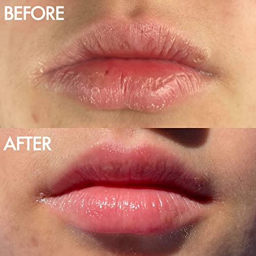Lanolips Lip Hydration Duo ? Tinted Lip Balm Rhubarb (0.44 oz) + 101 Multipurpose Ointment Coconutter (0.35 oz) ? Nourishing Lip Care with Natural Aussie Lanolin