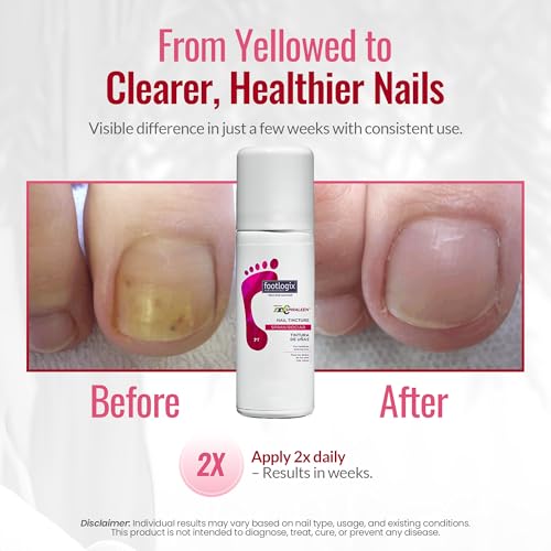 Footlogix Nail Tincture Spray with Tea Tree Oil & Avocado