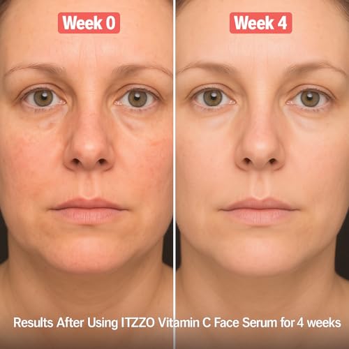 Vitamin C Face Serum - Anti Aging Serum with Hyaluronic Acid & Retinol - ITZZO