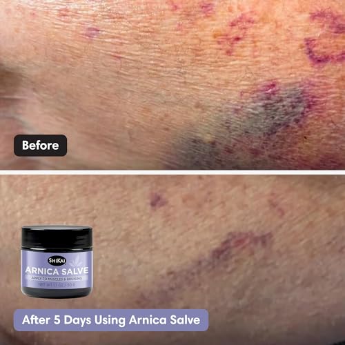 ShiKai Arnica Salve (1.7 oz) | Soothing Arnica Cream for Muscle Bruising | Moisturizing Body Barrier Lotion with Eucalyptus, Shea Butter & Beeswax