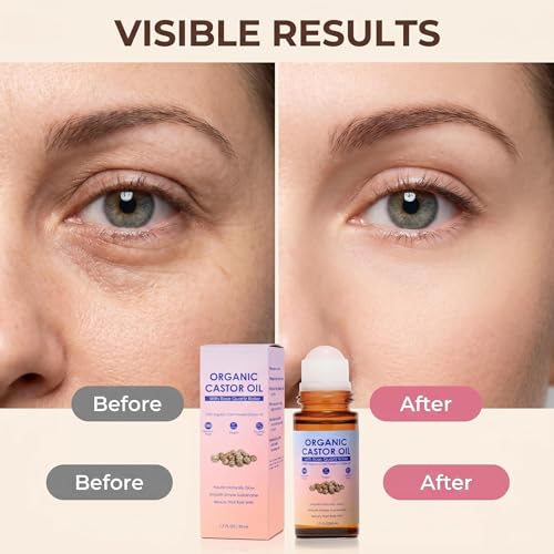 Organic Castor Oil Roll-On with Rose Quartz Roller - 100% Pure Moisturizer for Face, Hair & Eyebrows