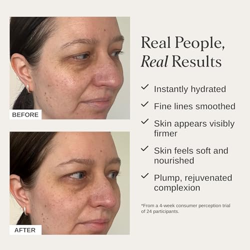 Alpha-H Firming Collagen Repair Face Cream 50ml ? Barrier Support Moisturizer for Dry, Dehydrated Skin ? Smooths Fine Lines & Boosts Elasticity