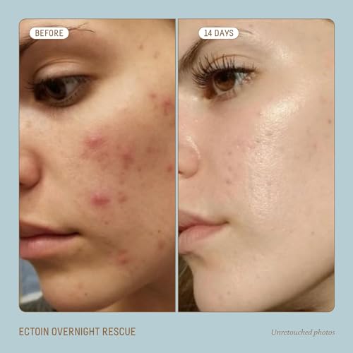 Biossance Squalane + Ectoin Overnight Rescue Face Cream ? Intensive 24h Hydration for Dry/Sensitive Skin ? Boosts Repair, Smoothens, Rejuvenates ? Use as Moisturizer/Overnight Mask, 1.7oz