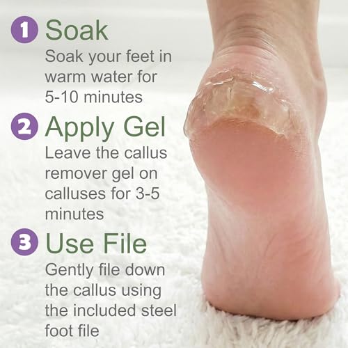 EntreFeet Extra Strength Foot Callus Remover Gel Kit with Stainless File - 4 oz