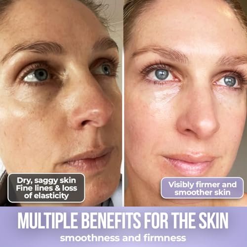 Collagen Face Moisturizer, Ultra Moisturizing Cream for Face, Body & Hands, 24 hours Moisturization, Avoids Wrinkles & Improves the Firmness and Elasticity of the Skin - 120 ml - Pack of 1