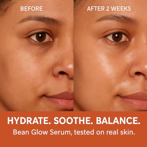 Snail Free Mucin Serum,Bean Essence 50,000ppm Korean skin care,Facial Glow Moisturizer for Glass skin? Hydrating Boost,Unscented Soothing Moisturizer? Strengthens Skin Barrier ? 1.01 fl.oz