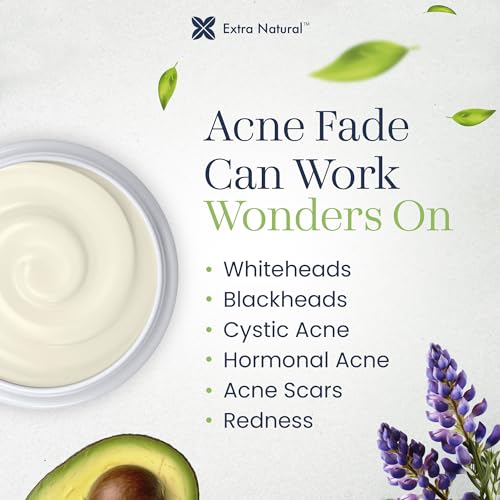 ExtraNatural Acne Cream ? Natural & Gentle Acne Treatment for Sensitive & Oily Skin ? Helps Reduce Breakouts, Pimples & Redness