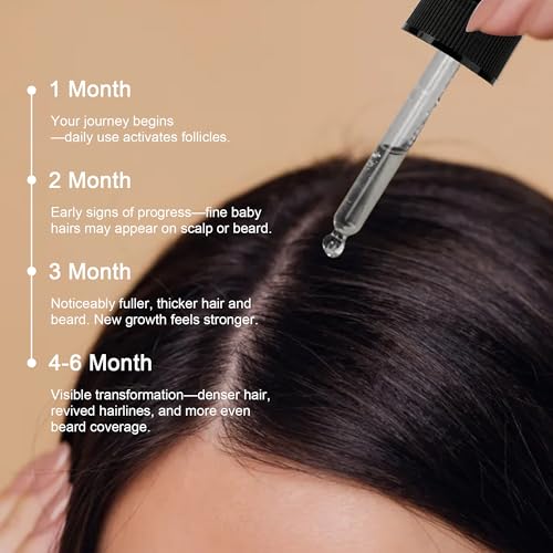 Minoxidil Hair Growth Serum 5% for Men & Women - 3 Pack | Hair Regrowth Treatment