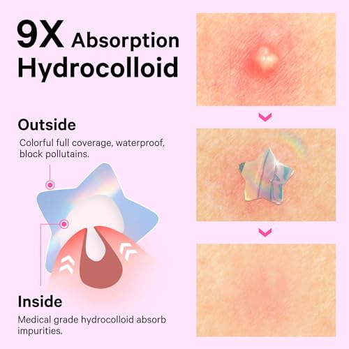 Sosky Hologram Pimple Patches, Hydrocolloid Acne Stickers, 48 Count